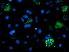 Anti-ACSM5 mouse monoclonal antibody (M14033) immunofluorescent staining of COS7 cells transiently transfected by pCMV6-ENTRY ACSM5