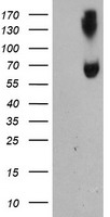 HEK293T cells were transfected with the pCMV6-ENTRY control (Left lane) or pCMV6-ENTRY ACSM5 (Right lane) cDNA for 48 hrs and lysed