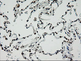 m14039 1 anti znf447 zscan18 mouse monoclonal antibody clone id oti2h7 ihc testing 11