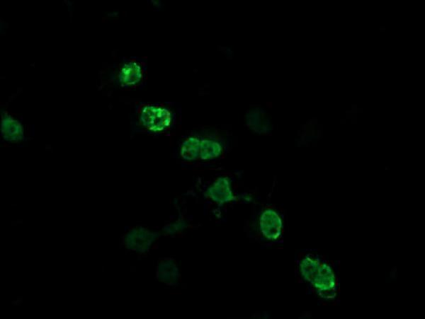 Anti-ZSCAN18 mouse monoclonal antibody (M14039) immunofluorescent staining of COS7 cells transiently transfected by pCMV6-ENTRY ZSCAN18