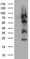 HEK293T cells were transfected with the pCMV6-ENTRY control (Left lane) or pCMV6-ENTRY ZSCAN18 (Right lane) cDNA for 48 hrs and lysed