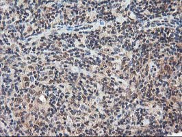 m14058 anti nudt18 mouse monoclonal antibody clone id oti5d7 ihc testing 10