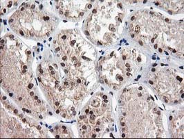 m14058 anti nudt18 mouse monoclonal antibody clone id oti5d7 ihc testing 12