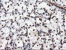 m14058 anti nudt18 mouse monoclonal antibody clone id oti5d7 ihc testing 13