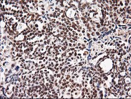 m14058 anti nudt18 mouse monoclonal antibody clone id oti5d7 ihc testing 2