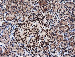 m14058 anti nudt18 mouse monoclonal antibody clone id oti5d7 ihc testing 3