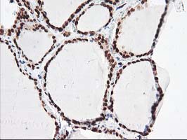 m14058 anti nudt18 mouse monoclonal antibody clone id oti5d7 ihc testing 4