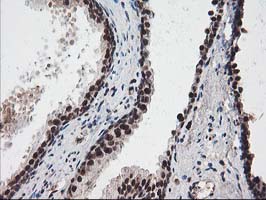 m14058 anti nudt18 mouse monoclonal antibody clone id oti5d7 ihc testing 8