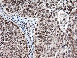 m14058 anti nudt18 mouse monoclonal antibody clone id oti5d7 ihc testing 9