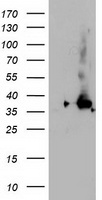m14058 anti nudt18 mouse monoclonal antibody clone id oti5d7 wb testing 1