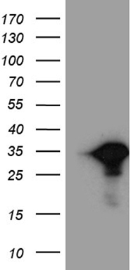 m14059 anti mlc1sa myl6b mouse monoclonal antibody clone id oti7f10 wb testing 1
