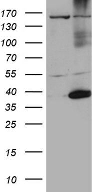 HEK293T cells were transfected with the pCMV6-ENTRY control (Left lane) or pCMV6-ENTRY HSF2BP (Right lane) cDNA for 48 hrs and lysed