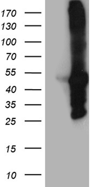 HEK293T cells were transfected with the pCMV6-ENTRY control (Left lane) or pCMV6-ENTRY MYBPC2 (Right lane) cDNA for 48 hrs and lysed