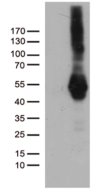HEK293T cells were transfected with the pCMV6-ENTRY control (Left lane) or pCMV6-ENTRY PDCD2L (Right lane) cDNA for 48 hrs and lysed