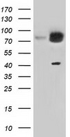 HEK293T cells were transfected with the pCMV6-ENTRY control (Left lane) or pCMV6-ENTRY KBTBD7 (Right lane) cDNA for 48 hrs and lysed. Equivalent amounts of cell lysates (5 ug per lane) were separated by SDS-PAGE and immunoblotted with anti-KBTBD7.
