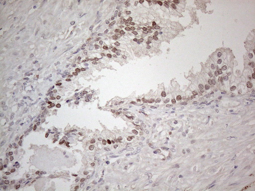 Immunohistochemical staining of paraffin-embedded Human prostate tissue within the normal limits using anti-HMGB4 mouse monoclonal antibody