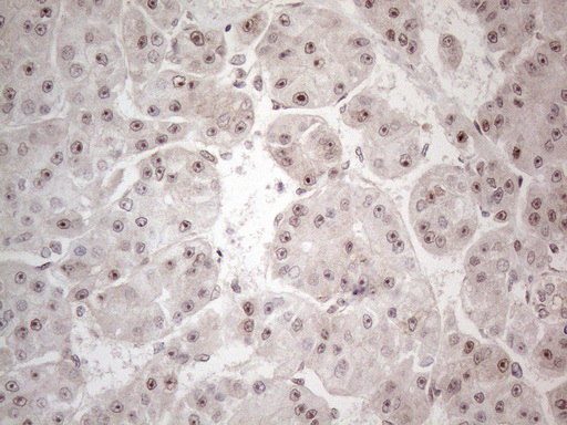 m14163 anti hmgb4 mouse monoclonal antibody clone id oti5g3 ihc testing 6
