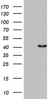 HEK293T cells were transfected with the pCMV6-ENTRY control (Left lane) or pCMV6-ENTRY PLEK2 (Right lane) cDNA for 48 hrs and lysed