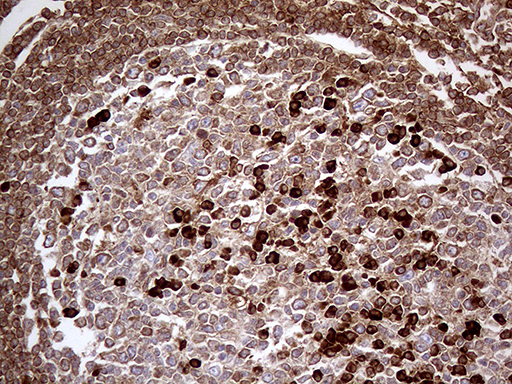 Immunohistochemical staining of paraffin-embedded Human lymph node tissue within the normal limits using anti-METTL7A mouse monoclonal antibody