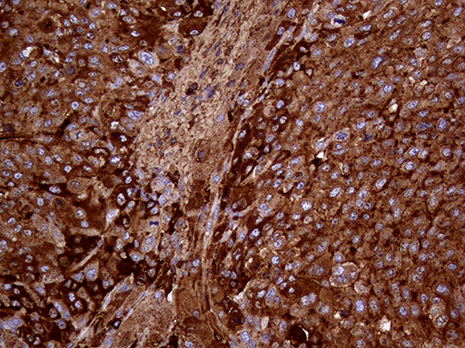 m14279 anti mettl7a mouse monoclonal antibody clone id oti4b10 ihc testing 4