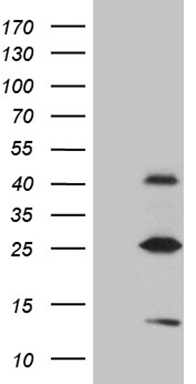 HEK293T cells were transfected with the pCMV6-ENTRY control (Left lane) or pCMV6-ENTRY METTL7A (Right lane) cDNA for 48 hrs and lysed