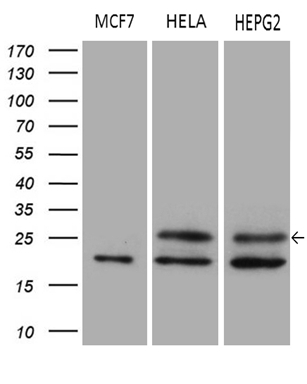 Western blot analysis of extracts (35ug) from 3 different cell lines by using anti-METTL7A monoclonal antibody (1:500)