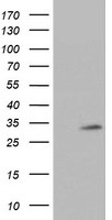 HEK293T cells were transfected with the pCMV6-ENTRY control (Left lane) or pCMV6-ENTRY TPSG1 (Right lane) cDNA for 48 hrs and lysed