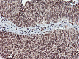 m14320 anti tpsg1 mouse monoclonal antibody clone id oti1g1 ihc testing 4