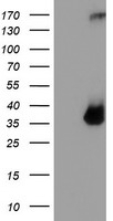 HEK293T cells were transfected with the pCMV6-ENTRY control (Left lane) or pCMV6-ENTRY TPSG1 (Right lane) cDNA for 48 hrs and lysed
