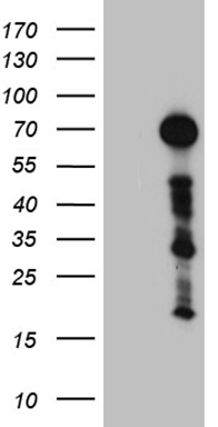 HEK293T cells were transfected with the pCMV6-ENTRY control (Left lane) or pCMV6-ENTRY ZFP37 (Right lane) cDNA for 48 hrs and lysed. Equivalent amounts of cell lysates (5 ug per lane) were separated by SDS-PAGE and immunoblotted with anti-ZFP37 (1:2000).