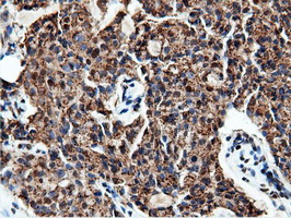 m14395 1 anti nt5dc1 mouse monoclonal antibody clone id oti3h2 ihc testing 13
