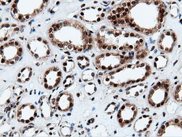 m14395 1 anti nt5dc1 mouse monoclonal antibody clone id oti3h2 ihc testing 14