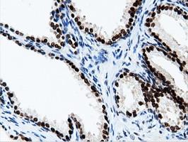 m14395 anti nt5dc1 mouse monoclonal antibody clone id oti1e11 ihc testing 10