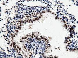 m14395 anti nt5dc1 mouse monoclonal antibody clone id oti1e11 ihc testing 11