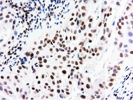 m14395 anti nt5dc1 mouse monoclonal antibody clone id oti1e11 ihc testing 12