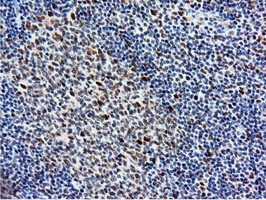 m14395 anti nt5dc1 mouse monoclonal antibody clone id oti1e11 ihc testing 13