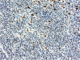 m14395 anti nt5dc1 mouse monoclonal antibody clone id oti1e11 ihc testing 14