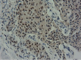 m14395 anti nt5dc1 mouse monoclonal antibody clone id oti1e11 ihc testing 15