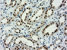 m14395 anti nt5dc1 mouse monoclonal antibody clone id oti1e11 ihc testing 16