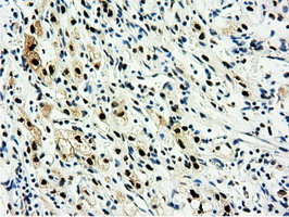 m14395 anti nt5dc1 mouse monoclonal antibody clone id oti1e11 ihc testing 17