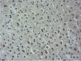 m14395 anti nt5dc1 mouse monoclonal antibody clone id oti1e11 ihc testing 18