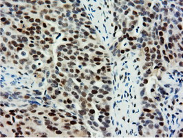m14395 anti nt5dc1 mouse monoclonal antibody clone id oti1e11 ihc testing 4