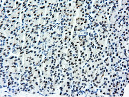 m14395 anti nt5dc1 mouse monoclonal antibody clone id oti1e11 ihc testing 5