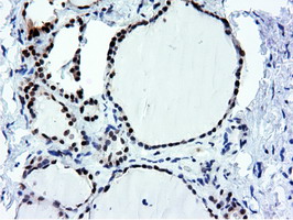 m14395 anti nt5dc1 mouse monoclonal antibody clone id oti1e11 ihc testing 7