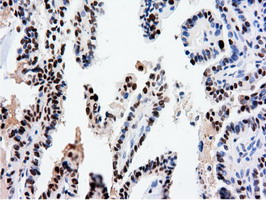 m14395 anti nt5dc1 mouse monoclonal antibody clone id oti1e11 ihc testing 8