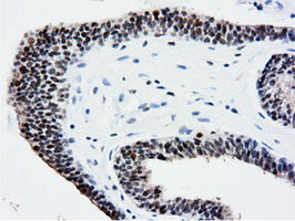 m14395 anti nt5dc1 mouse monoclonal antibody clone id oti1e11 ihc testing 9