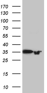 m14418 anti prps1l1 mouse monoclonal antibody clone id oti2c6 wb testing 1