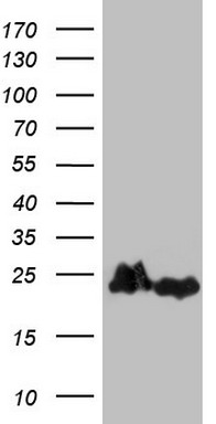 HEK293T cells were transfected with the pCMV6-ENTRY control (Left lane) or pCMV6-ENTRY EIF1AY (Right lane) cDNA for 48 hrs and lysed
