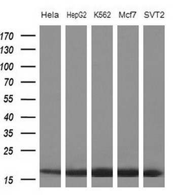 Western blot analysis of extracts (10ug) from 5 different cell lines by using anti-EIF1AY monoclonal antibody at 1:200 dilution