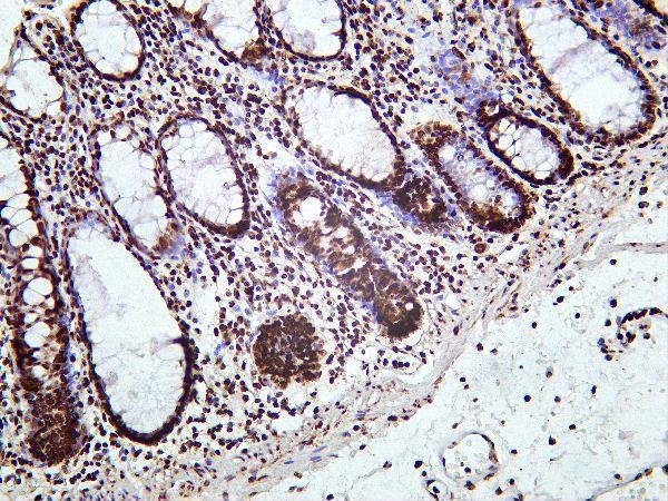 m14495 15 hist1h4a primary antibodies ihc testing 1